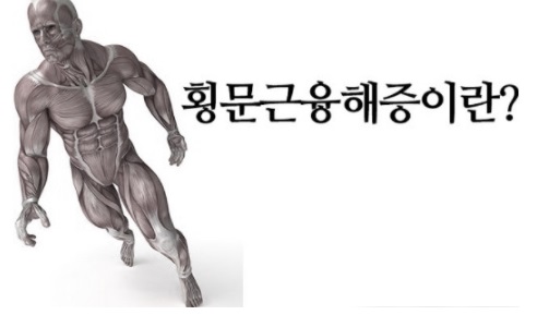 횡문근융해증