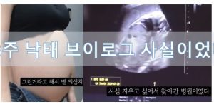 36주 낙태 브이로그